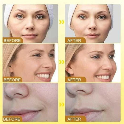 Botox Bee Venom Anti-Aging Cream for Face & Body